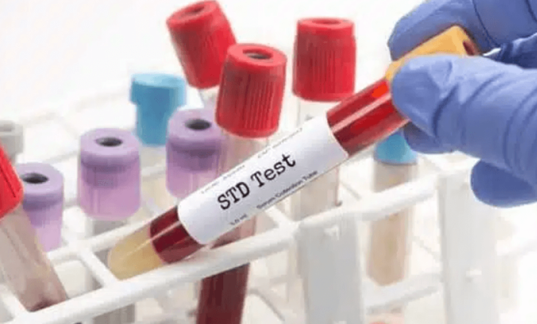 STD Test Dubai: How Early Detection Can Protect Your Future